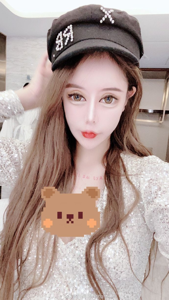 Ngoài những lần phẫu thuật có sự chấp thuận của gia đình, đôi lúc Tiểu Z Na Na còn lén bố mẹ, giả danh người trưởng thành để có thể dao kéo thuận tiện hơn.