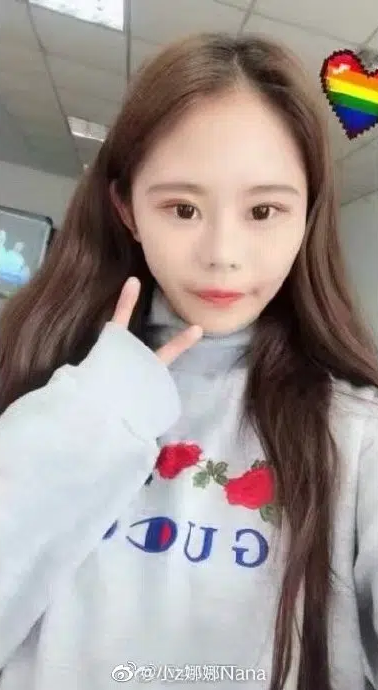 Lần đầu tiên Na Na đụng vào "dao kéo" là năm 2017. Khi ấy, cô được mẹ đưa đi làm phẫu thuật cắt mắt 2 mí, đây là ca phẫu thuật đầu tiên trong đời.