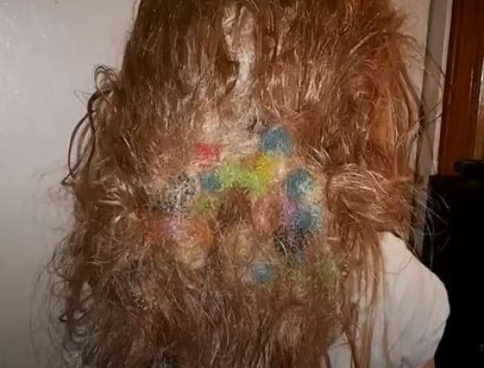 Sở dĩ món đồ chơi này bị tẩy chay bởi những gai nhỏ xíu trên các quả bóng, nguyên nhân gây ra thảm họa là khi để chúng bám vào tóc các bé, đặc biệt là những mái tóc dài của các bé gái.