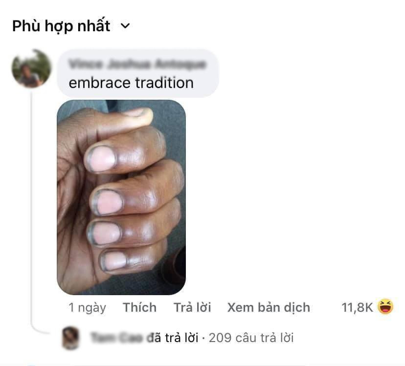 Đáng chú ý trong hình bộ nail được sơn màu trắng gạo theo màu móng tay nhưng điểm đặc biệt nằm ở phần đầu móng có màu xanh. Bộ nail này khiến nhiều người liên tưởng tới hình ảnh "chân lấm tay bùn" làm ruộng của người nông dân.