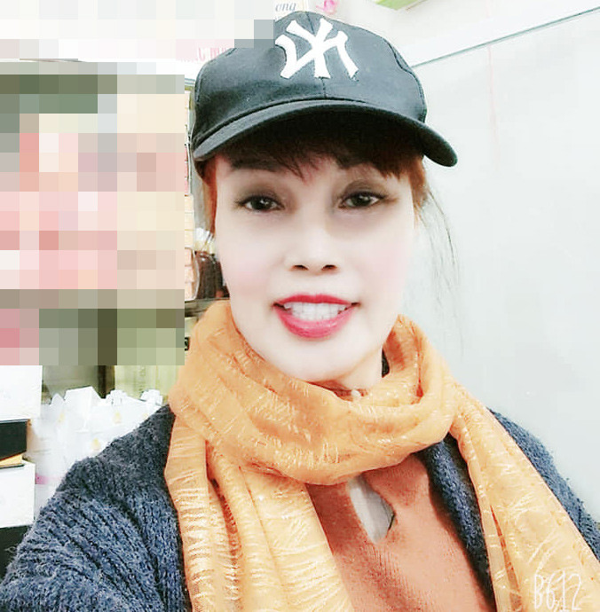 Dù có dùng phần mềm chỉnh ảnh để làn da mịn màng nhưng khi cười, chị Sao vẫn để lộ gương mặt méo lệch, không được tự nhiên.