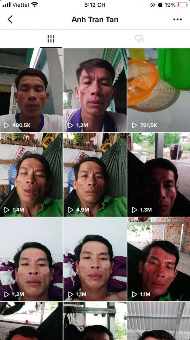 Tháng 10/2020, một người đàn ông Việt Nam có tài khoản TikTok tên Anh Tran Tan đã thu hút sự chú ý của dân mạng trong nước cũng như quốc tế vì những video có lượt xem "khủng".