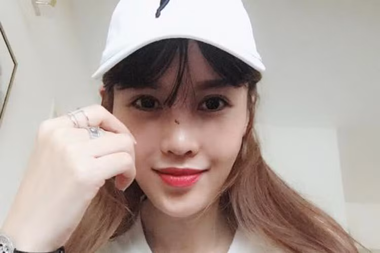 Quế Vân khoe mũi sau 6 lần dao kéo.