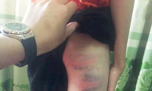 Hiện Công an huyện Đô Lương đang phối hợp với Công an xã Thái Sơn vào cuộc để điều tra, làm rõ vụ việc.