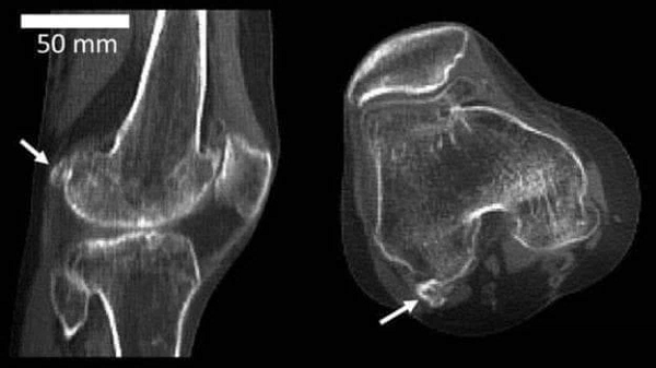 Các nhà khoa học cho rằng, quá trình tiến hóa của loài người chưa bao giờ dừng lại. Sẽ vẫn có một số đặc điểm biến đổi ngày càng trở nên phổ biến ở nhiều người hơn. Cũng sẽ có một số đặc điểm nhất định đã bị loại bỏ và trở nên ít phổ biến hơn trong quần thể loài người.