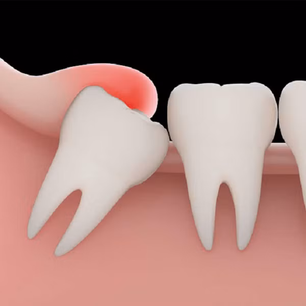 Số người có răng khôn cũng ngày càng giảm. Mắt xanh cũng là một kiểu hình mới xuất hiện, và các nhà khoa học đã xác định rằng nguồn gốc của nó là từ một đột biến cách đây khoảng 6.000 tới 10.000 năm.