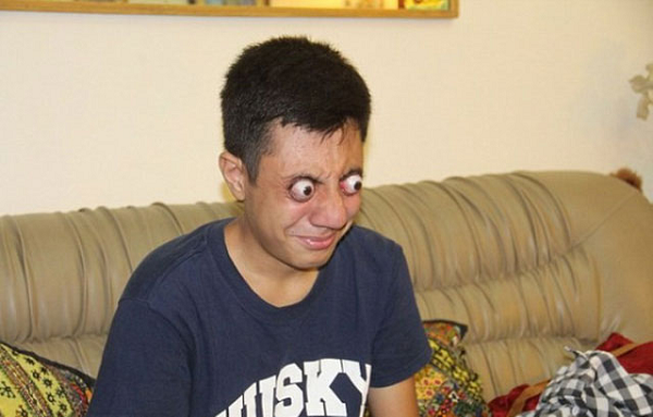 Thiếu niên 16 tuổi Ahmed Khan đến từ Lahore thuộc tỉnh Punjab, Pakistan cũng sở hữu khả năng đặc biệt với đôi mắt của mình.