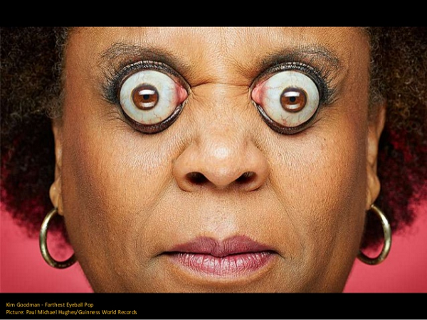 Mới đầu, đây chỉ là khả năng bị động, thế nhưng theo thời gian, cô Kim cho biết, cô có thể thoải mái điều khiển nhãn cầu lồi ra khỏi hốc mắt bất cứ khi nào cô muốn.