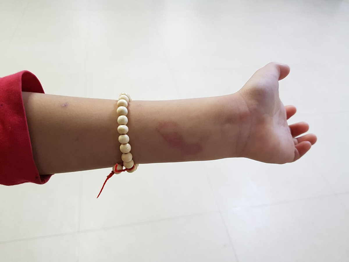 Co giao bi tam dinh chi do bi to danh hoc sinh tham tim-Hinh-2