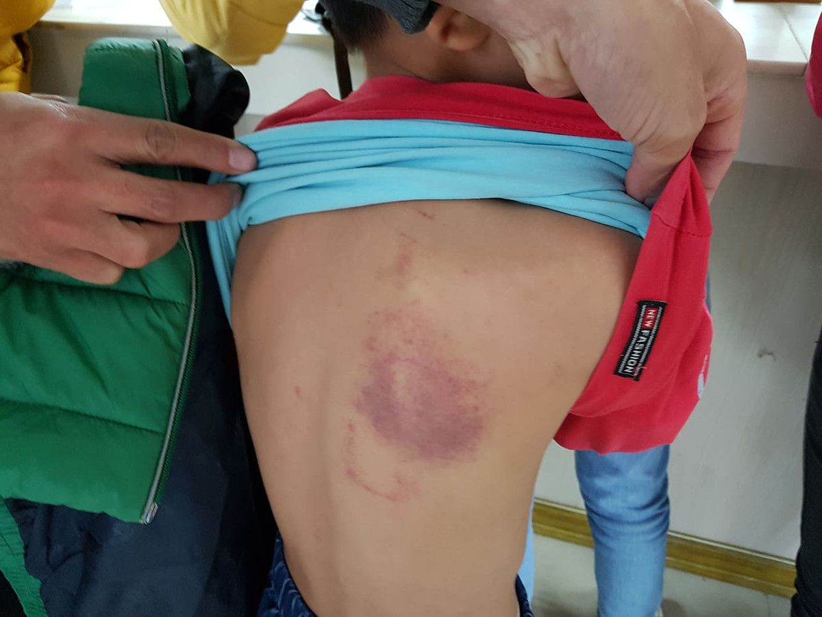 Co giao bi tam dinh chi do bi to danh hoc sinh tham tim