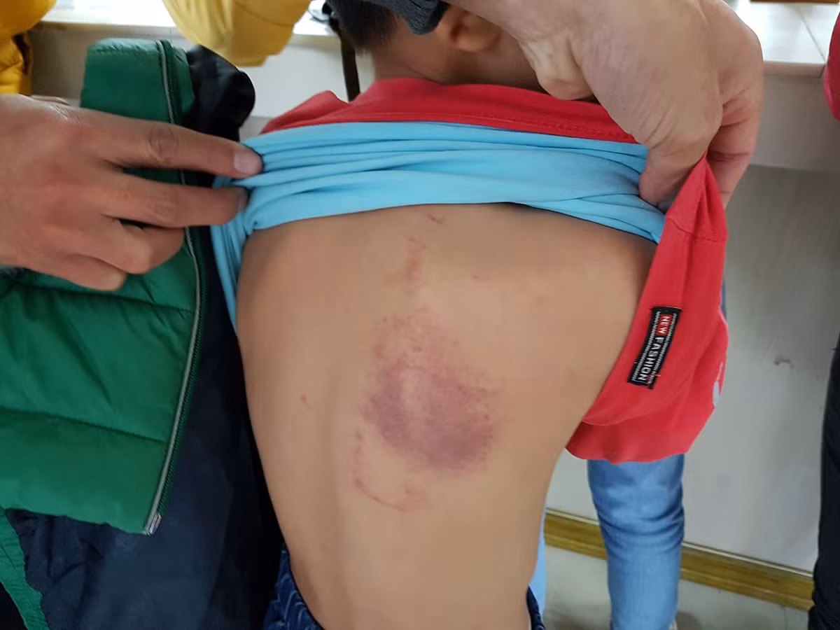 Co giao bi tam dinh chi do bi to danh hoc sinh tham tim