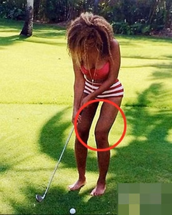 Khoảnh khoắc nữ ca sĩ Beyoncé sở hữu đôi chân không đều.