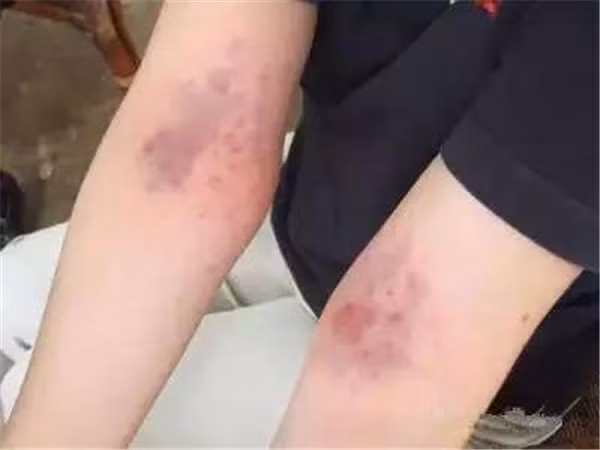 Duy trì cách vỗ này liên tiếp sẽ giúp cơ thể được thanh lọc, khỏe mạnh, độc tố sẽ tiêu tan dễ dàng.