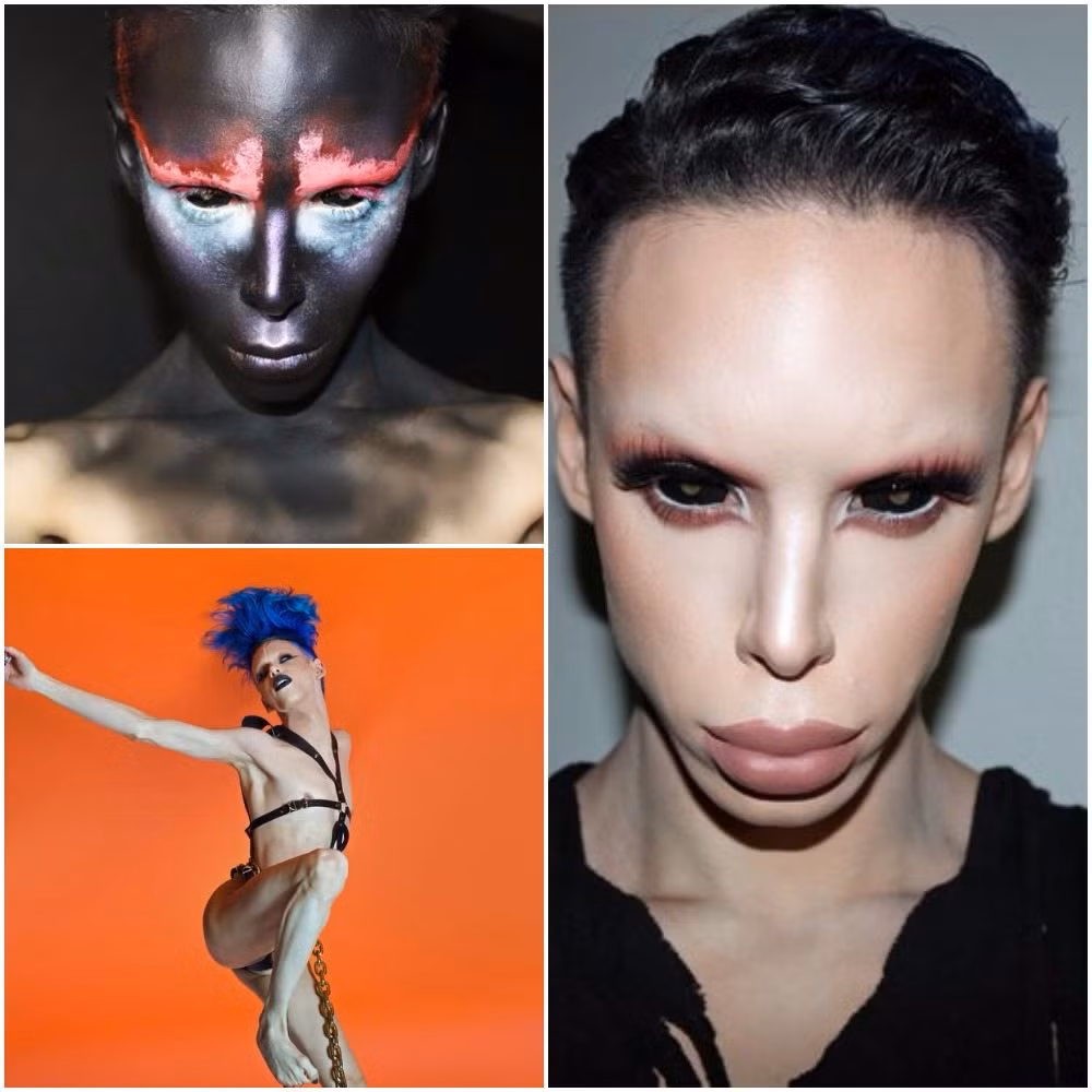 Chàng trai Vinny Ohh, 23 tuổi người Los Angeles Mỹ, người chi tới 50.000 bảng khoảng 1,5 tỷ đồng thực hiện tới 110 cuộc phẫu thuật, để biến đổi hoàn toàn cơ thể mình.