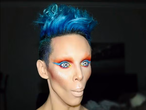 Cận cảnh khuôn mặt biến dạng đã qua nhiều lần phẫu thuật chỉnh sửa của Vinny.