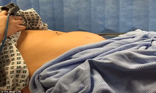 Nhiem doc bang ve sinh nguoi mat tri nho, ke bi than chet so gay-Hinh-2