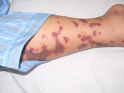 Bì lợn nấu với đại táo dùng để trị các bệnh chảy máu chân răng, xuất huyết da… Ảnh: Dân trí.