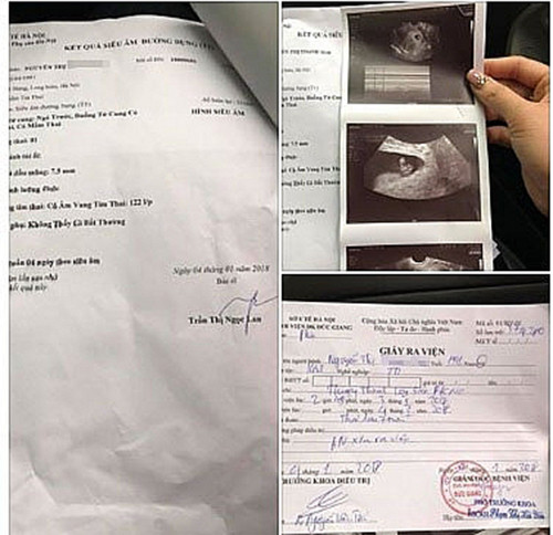 Kết quả thăm khám, siêu âm của chị M. tại bệnh viện đa khoa Đức Giang (Hà Nội).