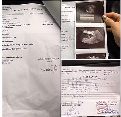 Kết quả thăm khám, siêu âm của chị M. tại bệnh viện đa khoa Đức Giang (Hà Nội).