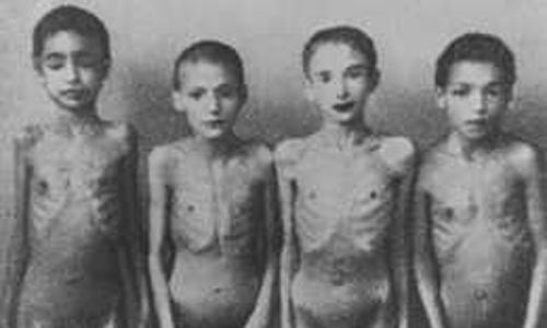 Nhóm trẻ em đáng thương này là nạn nhân thí nghiệm y tế của tiến sĩ Josef Mengele tại trại Auschwitz-Birkenau, Ba Lan năm 1944.
