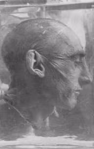 Am anh nan nhan bi phat xit Duc thi nghiem man ro