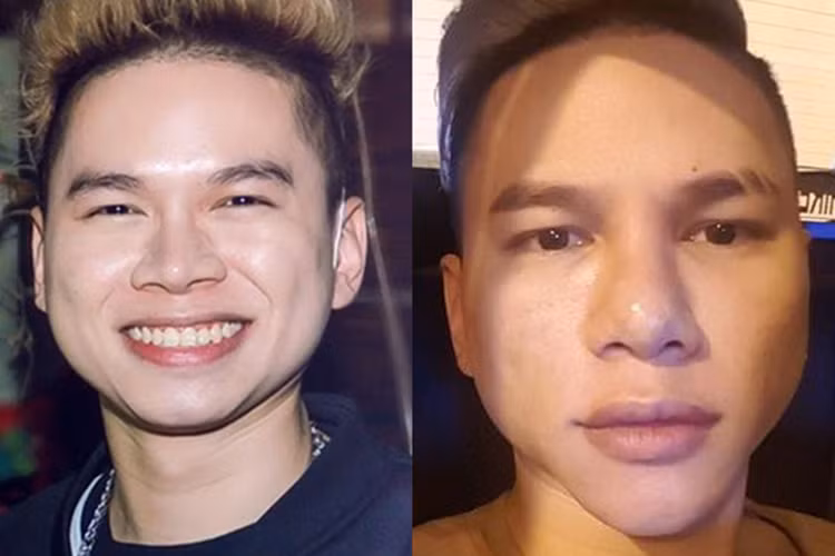 Hoàng Tôn thừa nhận bản thân đã phẫu thuật thẩm mỹ. So với trước kia, diện mạo của anh đã có sự khác biệt với chiếc mũi cao, cằm dài và mí mắt rõ hơn. Ảnh: Dân Việt