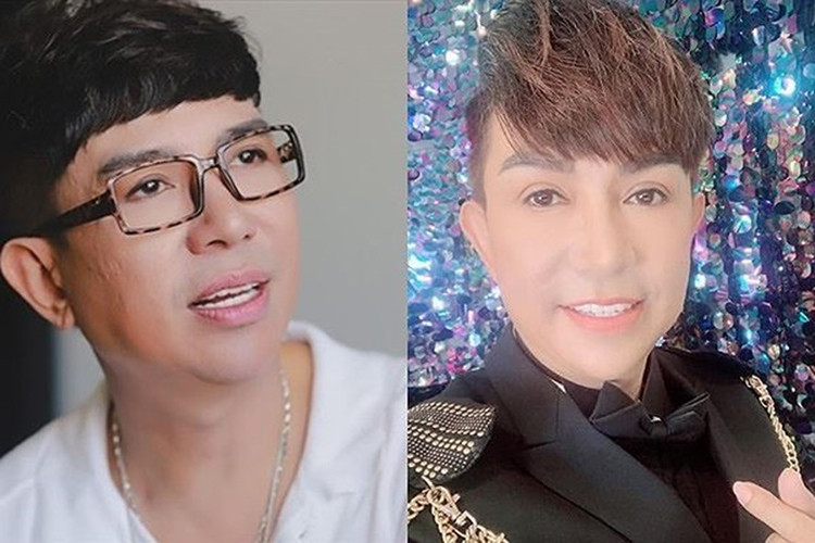 Ngoài thừa nhận dao kéo, Long Nhật còn khoe cận cảnh gương mặt đã chỉnh sửa của mình. Bên cạnh những lời khen, một số ý kiến chê gương mặt của Long Nhật vẫn còn sưng. Ảnh: Lao động