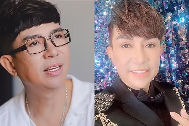 Ngoài thừa nhận dao kéo, Long Nhật còn khoe cận cảnh gương mặt đã chỉnh sửa của mình. Bên cạnh những lời khen, một số ý kiến chê gương mặt của Long Nhật vẫn còn sưng. Ảnh: Lao động