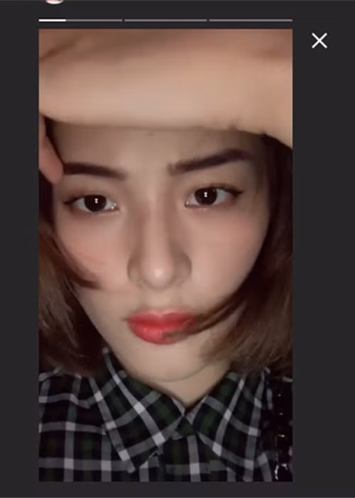 Nhan sắc thất thường của Hạ Vi chỉ trong vài ngày khiến không ít người hoang mang. Ảnh: Gia đình Việt Nam