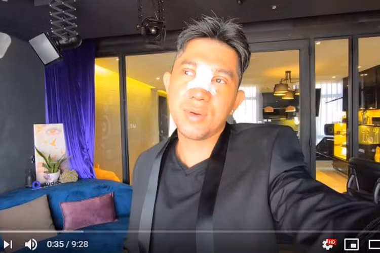 Gần đây, Lương Bằng Quang bất ngờ công khai chuyện dao kéo. Nam ca sĩ chia sẻ, anh chỉnh sửa gương mặt vì muốn tự tin hơn vào bản thân. Được biết, Lương Bằng Quang đã nâng mí, sửa mũi, độn cằm.