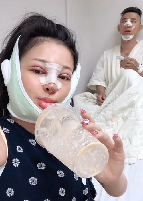 Lương Bằng Quang đã cùng với bạn gái của anh - Ngân 98 thay đổi diện mạo nhờ phẫu thuật thẩm mỹ.