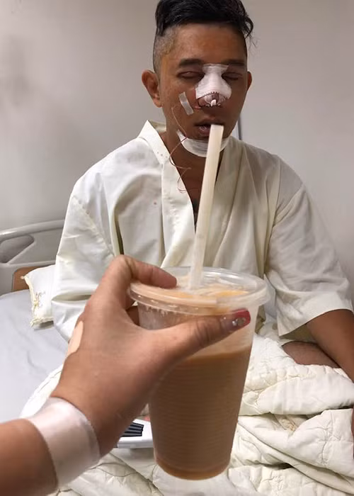 Một số hình ảnh sau phẫu thuật thẩm mỹ của Lương Bằng Quang được bạn gái chia sẻ trên trang cá nhân.