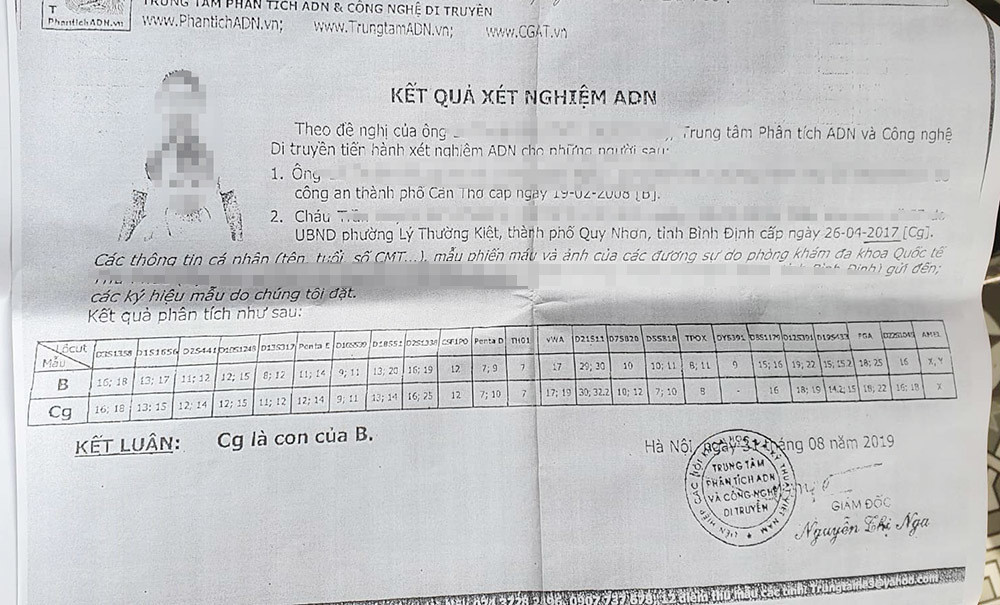 Nguyen pho giam doc So bi to bo con roi: 