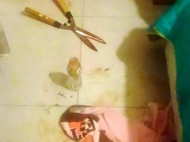 Bi lo “clip nong”, nguoi phu nu dung keo “triet san” nguoi tinh-Hinh-4