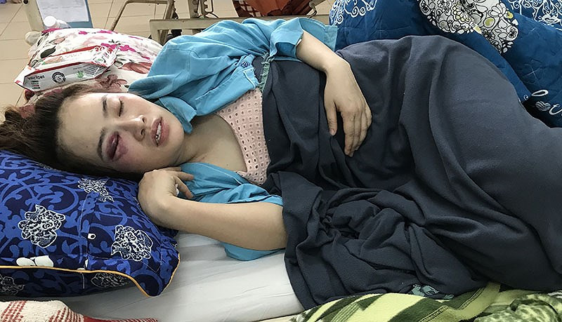 Yeu cau bat ngo cua co gai bi thanh nien danh vi...cai banh xeo