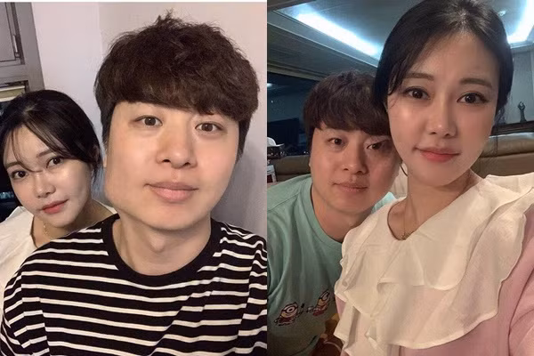 Vo nghe si hai bat chap “song ao”, chinh sua chong bien dang