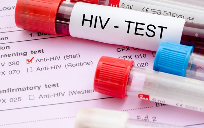 HIV/AIDS: HIV ảnh hưởng đến khả năng sản xuất hormone của cơ thể, bao gồm testosterone và estrogen. Điều này dẫn đến các vấn đề về tình dục và ham muốn giảm. Các loại thuốc tầm soát virus HIV cũng có thể cản trở đời sống tình dục, gây rối loạn cương dương ở nam giới. Ảnh: Health24.