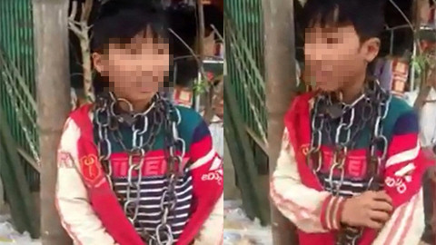 Bé N. bị chú ruột dùng xích quấn quanh cổ.