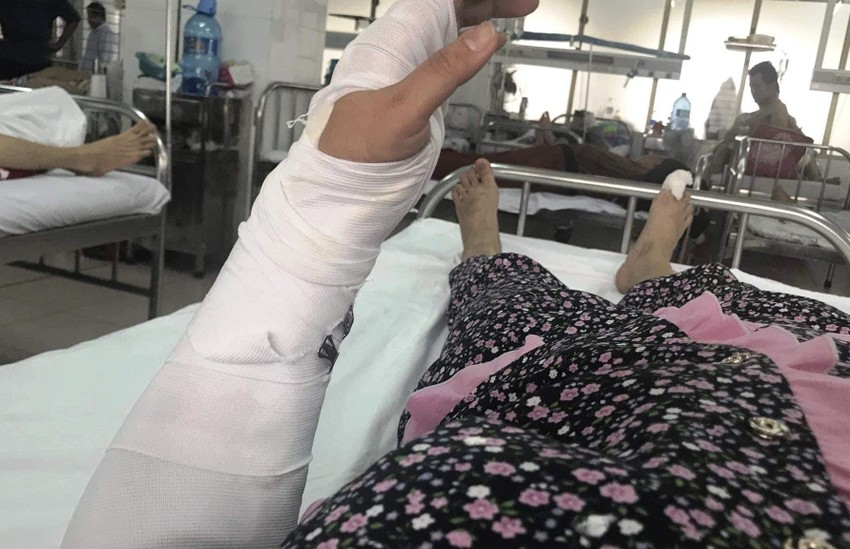 Cong an vao cuoc vu nguoi vo bi chong dam da da man-Hinh-2