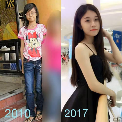 Chia sẻ ảnh “ dậy thì thành công” là trào lưu nổi rần rần trong giới trẻ Việt gần đây. Bên cạnh hình ảnh xinh đẹp, lộng lẫy của hiện tại, các cô gái không ngần ngại đăng ảnh thời còn xấu xí, đen nhẻm. Sự khác biệt lớn về nhan sắc trước và sau khi “dậy thì" chính là điểm thú vị của trào lưu này. Chỉ cần gõ dòng hashtag #daythithanhcong, có thể thấy hàng loạt bức ảnh “vịt hóa thiên nga” của các cô gái. Trong số đó, hình ảnh trước và sau 7 năm của một nữ sinh 19 tuổi được chia sẻ nhiều hơn cả. Tự ghép hình rồi đăng tải lên Facebook cá nhân, hình ảnh dậy thì thành công của Lê Trang (sinh năm 1998, Tuyên Quang, hiện là sinh viên một trường đại học tại TP.HCM) được nhiều Fanpage lớn đăng tải lại.