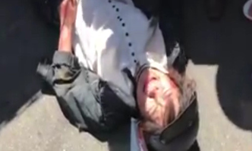 Nạn nhân bị kẹt dưới gầm cùng nhiều người khác bị thương trong vụ tai nạn được chuyển đi bệnh viện cấp cứu.