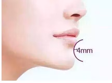 Cằm nhô và cong là tướng phụ nữ biến hóa thay đổi chóng mặt, thường chần chừ do dự thiếu khả năng quyết đoán. Nguồn ảnh: Sina.