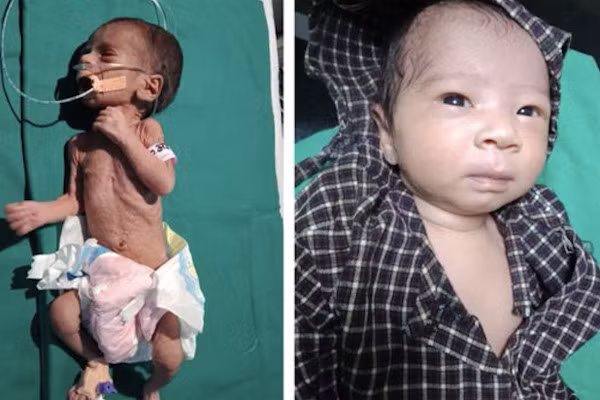 Be gai van song sot ky dieu sau khi bi chon sau gan 1m