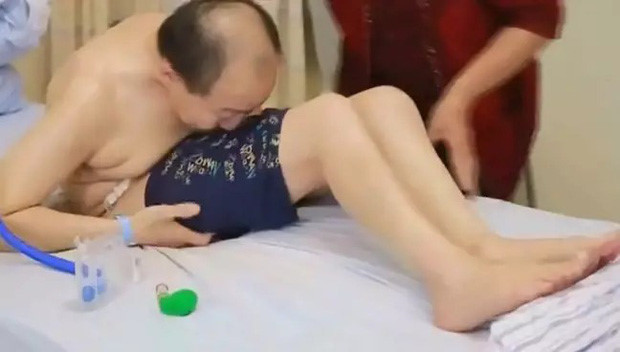 Nguoi dan ong song trong tu the gap doi nguoi suot 28 nam vi can benh la