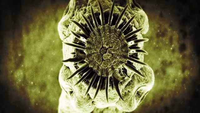 Không giống các loài giun ký sinh thông thường khác, ấu trùng sán dải lợn đôi khi xâm nhập vào bộ não con người, và “tiêu thụ” khối lượng khá lớn các mô thần kinh trong quá trình đó.