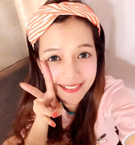 Nhung 9x Viet phau thuat tham my vit hoa thien nga hinh anh 5