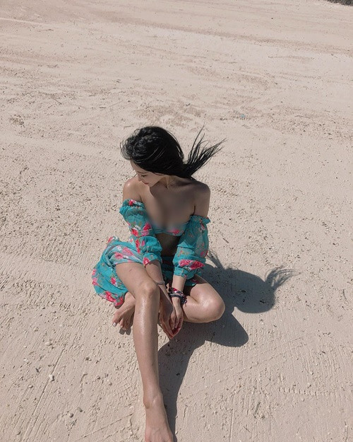 Do sở hữu thích diện đồ hở khi đi biển, Kim Geung-jeong có lúc bị cháy nắng từng mảng.