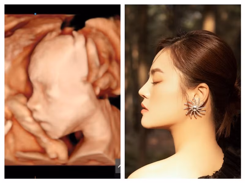 Thu Quỳnh mang bầu con gái. Nữ diễn viên từng chia sẻ, em bé trong bụng có gương mặt giống cô.