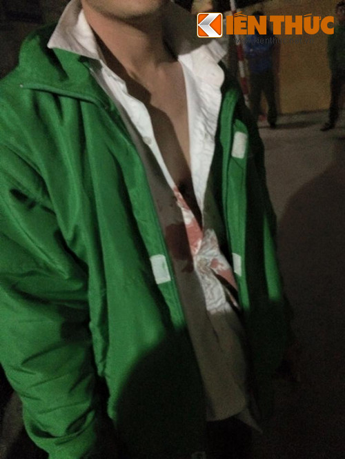 Truy bat hung thu cuop taxi luc nua dem o Ha Noi-Hinh-2