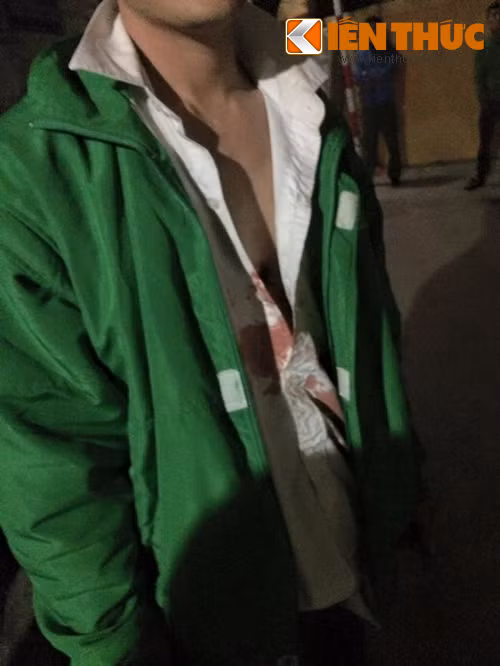 Truy bat hung thu cuop taxi luc nua dem o Ha Noi-Hinh-2